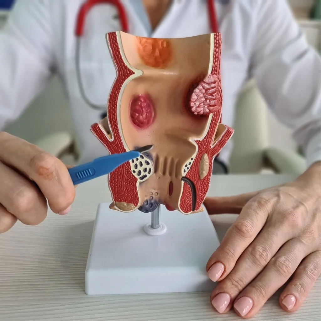 פרוקטולוגיה 1