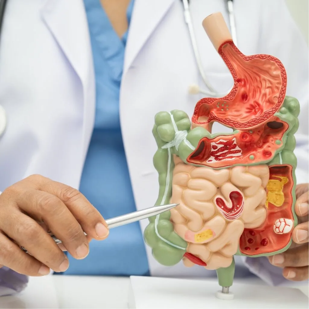 IBD גסטרואנטרולוגיה 1024x1024 1